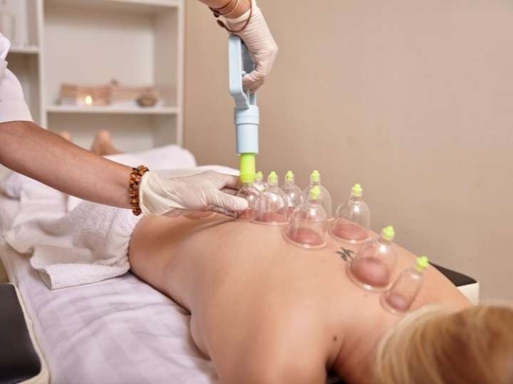 Sessão de Ventosaterapia no Núcleo Corpo e Alma, mostrando terapeuta aplicando ventosas nas costas para promover alívio de dores e desintoxicação.